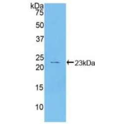 Heat Shock Protein Beta 2 (HSPb2) Antibody