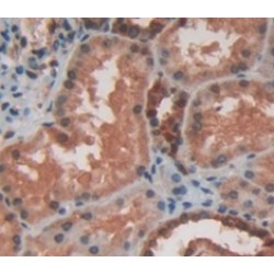 Heat Shock Protein Beta 2 (HSPb2) Antibody