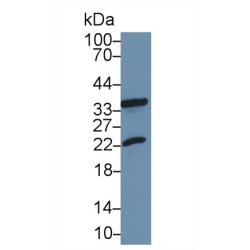 Heat Shock Protein Beta 2 (HSPb2) Antibody