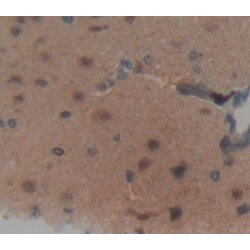 Heat Shock Protein Beta 6 (HSPb6) Antibody