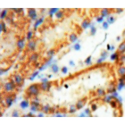 Heme Oxygenase 1, Decycling (HO1) Antibody