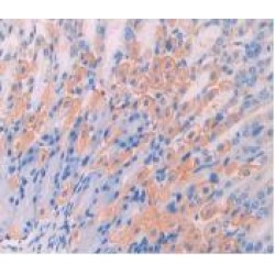 Leukocyte Surface Antigen CD47 (CD47) Antibody
