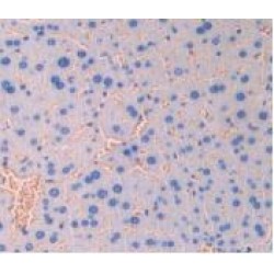 Leukocyte Surface Antigen CD47 (CD47) Antibody