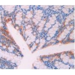 Leukocyte Surface Antigen CD47 (CD47) Antibody