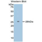 abx102662