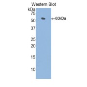 abx102664