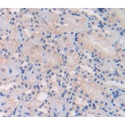 L1-Cell Adhesion Molecule (L1CAM) Antibody