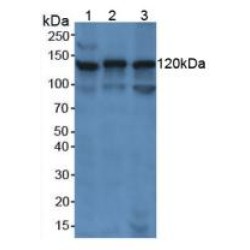 Poly ADP Ribose Polymerase 1 (PARP1) Antibody