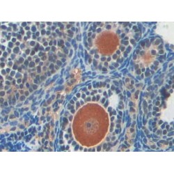 Poly ADP Ribose Polymerase 1 (PARP1) Antibody