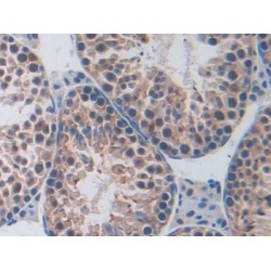 Poly ADP Ribose Polymerase 1 (PARP1) Antibody