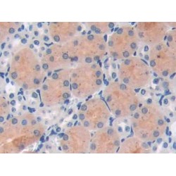 Poly ADP Ribose Polymerase 1 (PARP1) Antibody