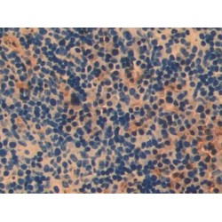 Poly ADP Ribose Polymerase 1 (PARP1) Antibody