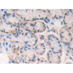 Poly ADP Ribose Polymerase 1 (PARP1) Antibody