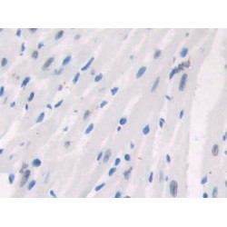 Poly ADP Ribose Polymerase 1 (PARP1) Antibody