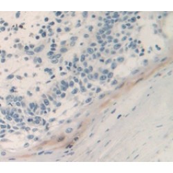 Prostate Stem Cell Antigen (PSCA) Antibody