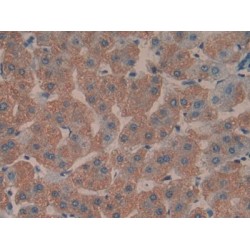 Toll Interacting Protein (TOLLIP) Antibody