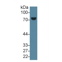 Protein-Glutamine Gamma-Glutamyltransferase 2 (TGM2) Antibody