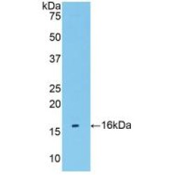 Transmembrane Protein 27 (TMEM27) Antibody