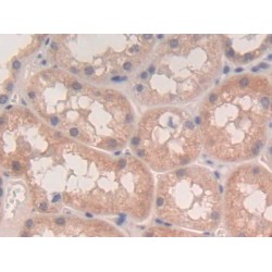 Lymphotoxin Alpha (LTA) Antibody