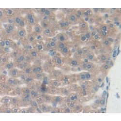 Lymphotoxin Alpha (LTA) Antibody