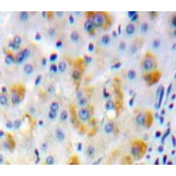 Adenylate Cyclase 2, Brain (ADCY2) Antibody