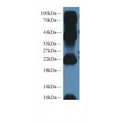 Western blot analysis of Mouse Testis lysate, using Human AGR2 Antibody (2 µg/ml) and HRP-conjugated Goat Anti-Rabbit antibody (<a href="https://www.abbexa.com/index.php?route=product/search&amp;search=abx400043" target="_blank">abx400043</a>, 0.2 µg/ml).