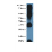 abx102710