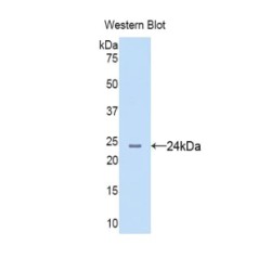 Anterior Gradient Protein 2 (AGR2) Antibody