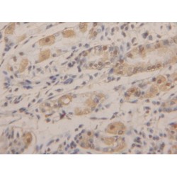 Anterior Gradient Protein 2 (AGR2) Antibody