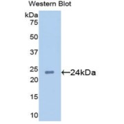abx102711