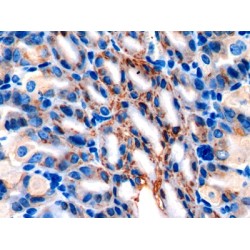 Anterior Gradient Protein 2 (AGR2) Antibody