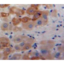 Anterior Gradient Protein 2 (AGR2) Antibody