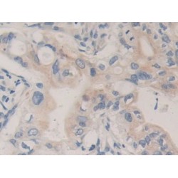 Carboxypeptidase B1, Tissue (CPB1) Antibody