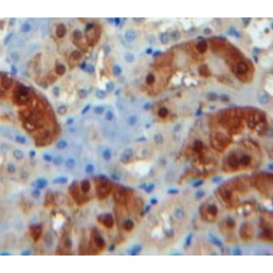 Carboxypeptidase B1, Tissue (CPB1) Antibody