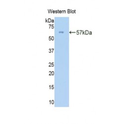 Collagen Type III Alpha 1 (COL3A1) Antibody