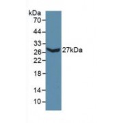 Western blot analysis of recombinant Mouse COL3a1.