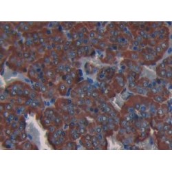 Collagen Alpha-1 III Chain (COL3A1) Antibody