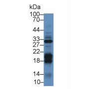 Western blot analysis of Mouse Liver lysate, using Mouse DGKa Antibody (2 µg/ml) and HRP-conjugated Goat Anti-Rabbit antibody (<a href="https://www.abbexa.com/index.php?route=product/search&amp;search=abx400043" target="_blank">abx400043</a>, 0.2 µg/ml).