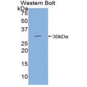 Western blot analysis of the recombinant protein.