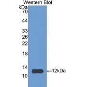 Western blot analysis of the recombinant protein.