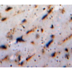 Heat Shock Protein Beta-1 (HSPB1) Antibody