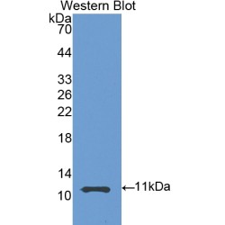 Heat Shock 70 kDa Protein 8 (HSPA8) Antibody
