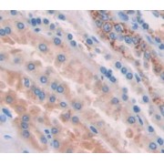 IHC-P analysis of Human Tissue, with DAB staining.