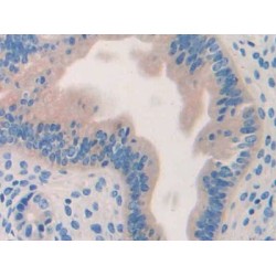 Hyaluronoglucosaminidase 1 (HYAL1) Antibody