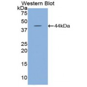 Western blot analysis of recombinant Mouse HYAL2.