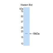 abx102760