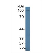 abx102761
