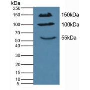 abx102762