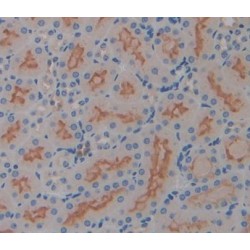 Interleukin 17 Receptor D (IL17RD) Antibody