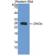 Western blot analysis of recombinant Mouse IL17RE.